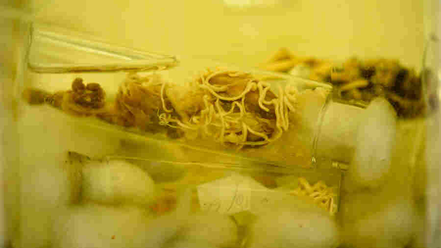 This is what's called a "specimen lot" — a large mason jar holding smaller vials of parasitic worms gathered by a researcher in 1927. The Smithsonian collection has more than 120,000 specimen lots.