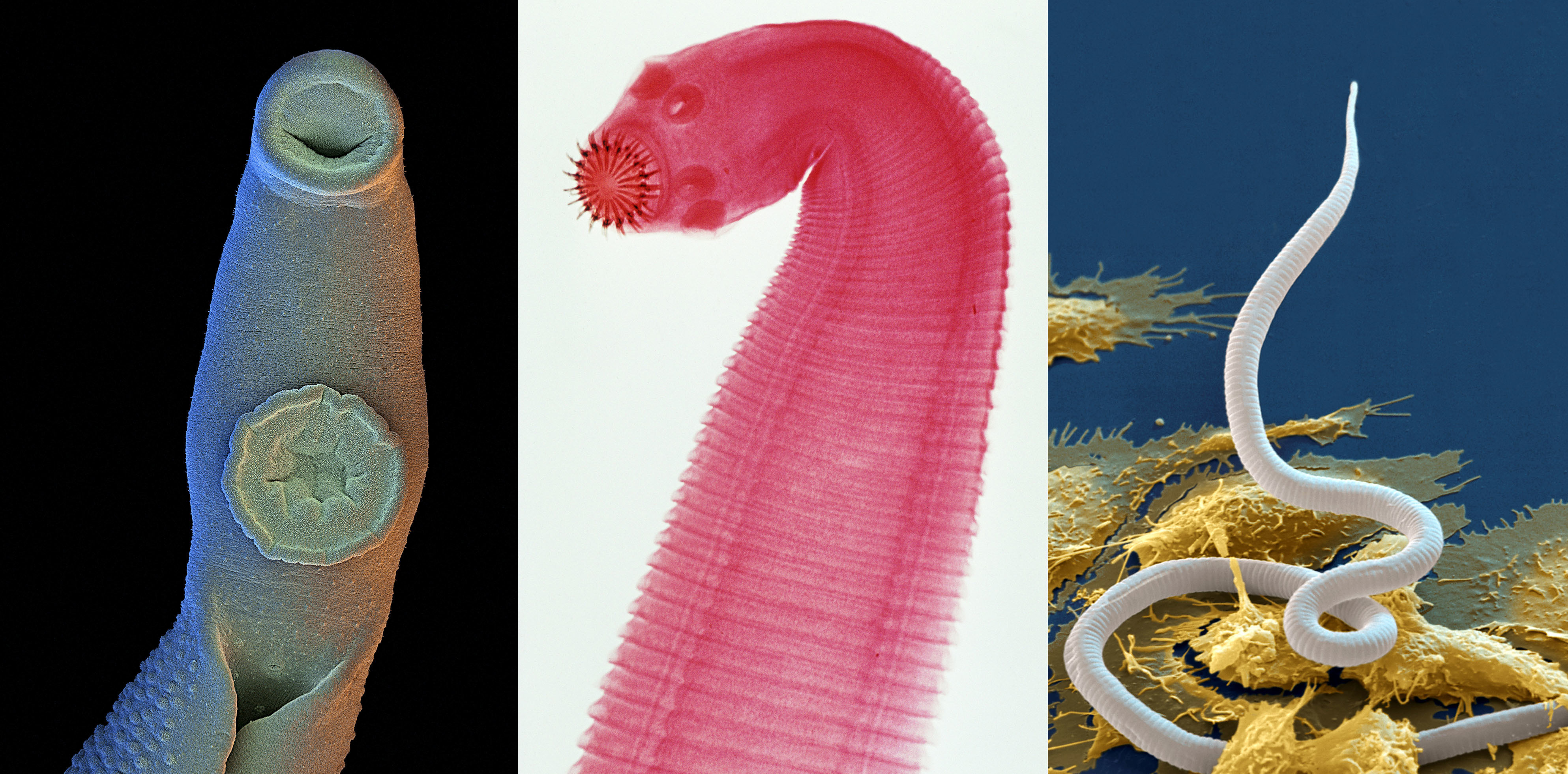 types of parasitic worms in humans