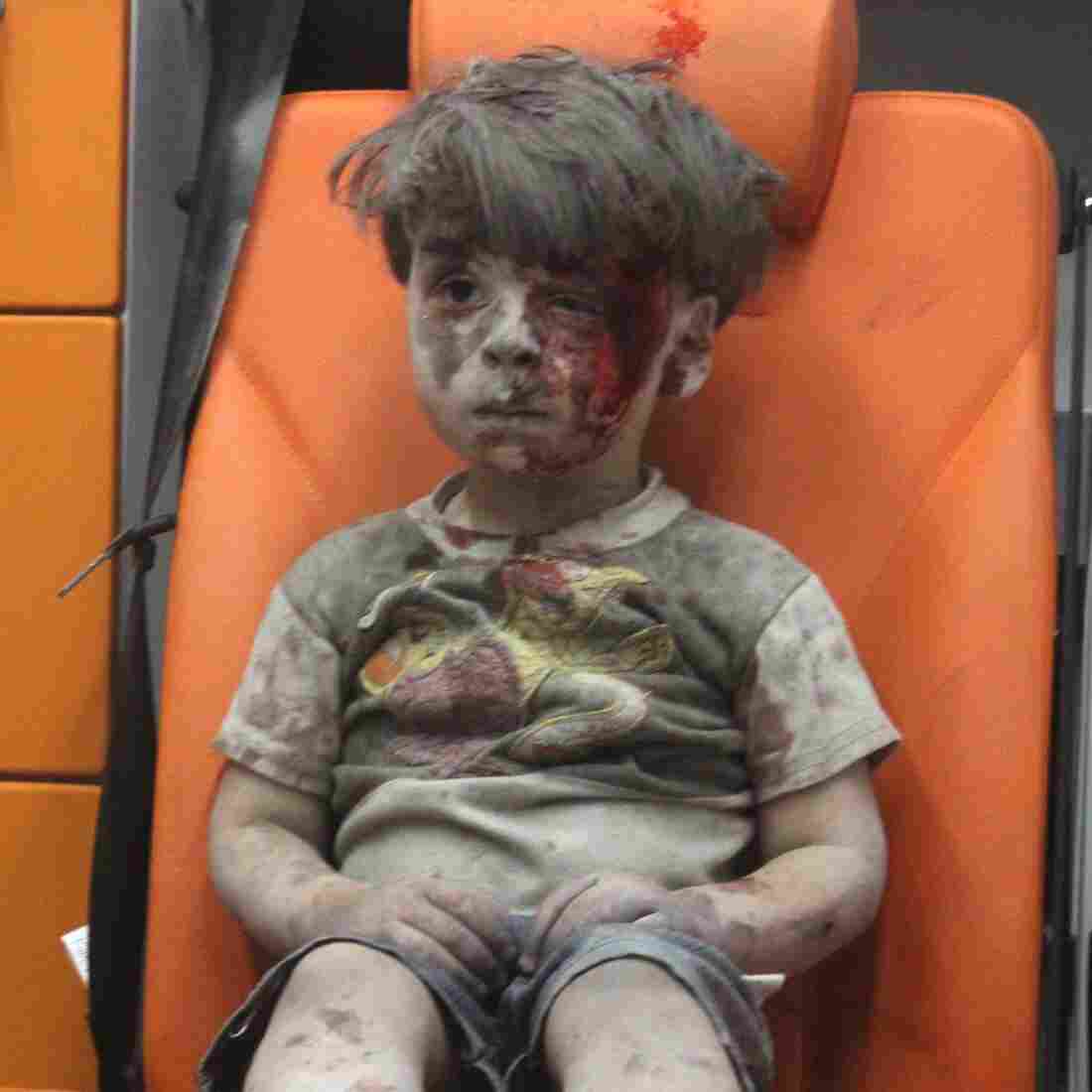 A Wounded Child In Aleppo, Silent And Still, Shocks The World