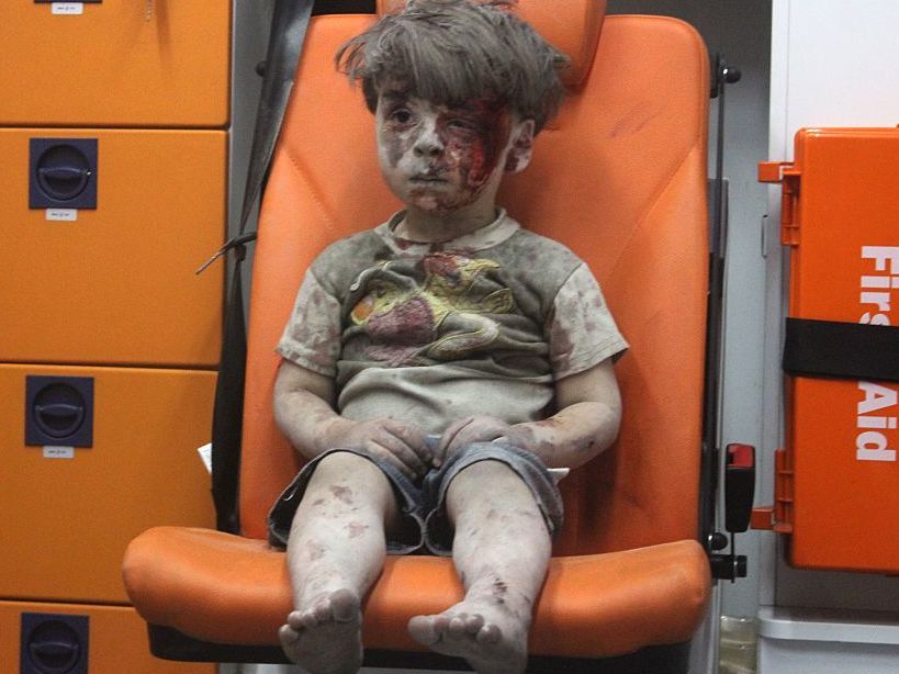 Omran Daqneesh sits in the back of an ambulance after he was injured during air strikes in Aleppo. (Getty Images)