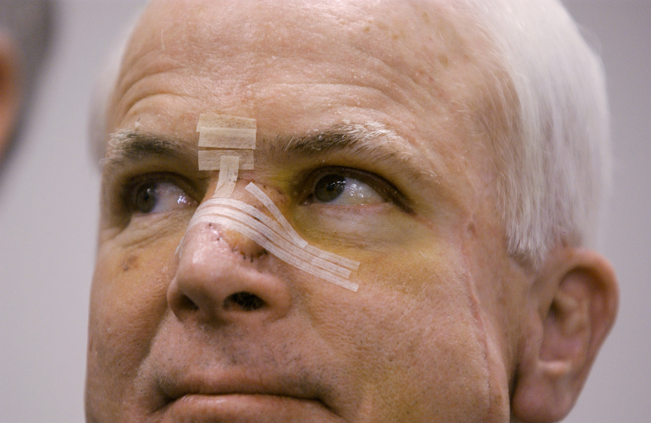 Former presidential candidate John McCain in 2002, with a bandaged nose after being treated for skin cancer. As a candidate, McCain was open about his health and allowed reporters to review more than 1,000 pages of his records over three hours. (Stephen J. Boitano/AP)