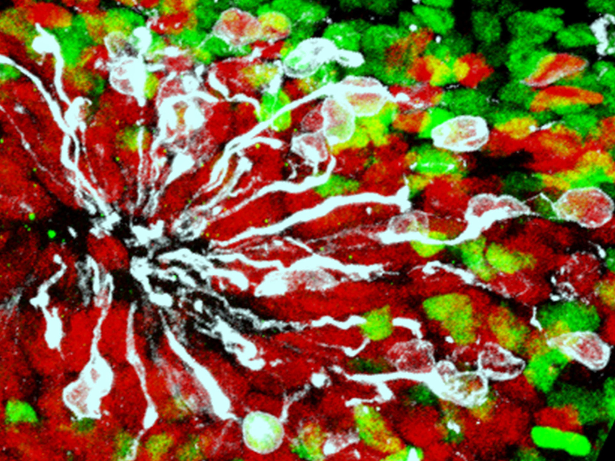 This image is from lab-grown brain tissue — a minibrain — infected by Zika virus (white) with neural stem cells in red and neuronal nuclei in green. (Courtesy of Xuyu Qian and Guo-li Ming)