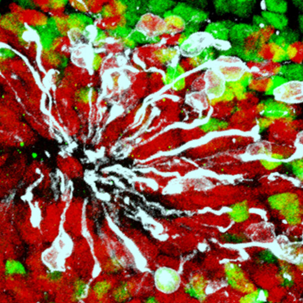 'Minibrains' Could Help Drug Discovery For Zika And For Alzheimer's