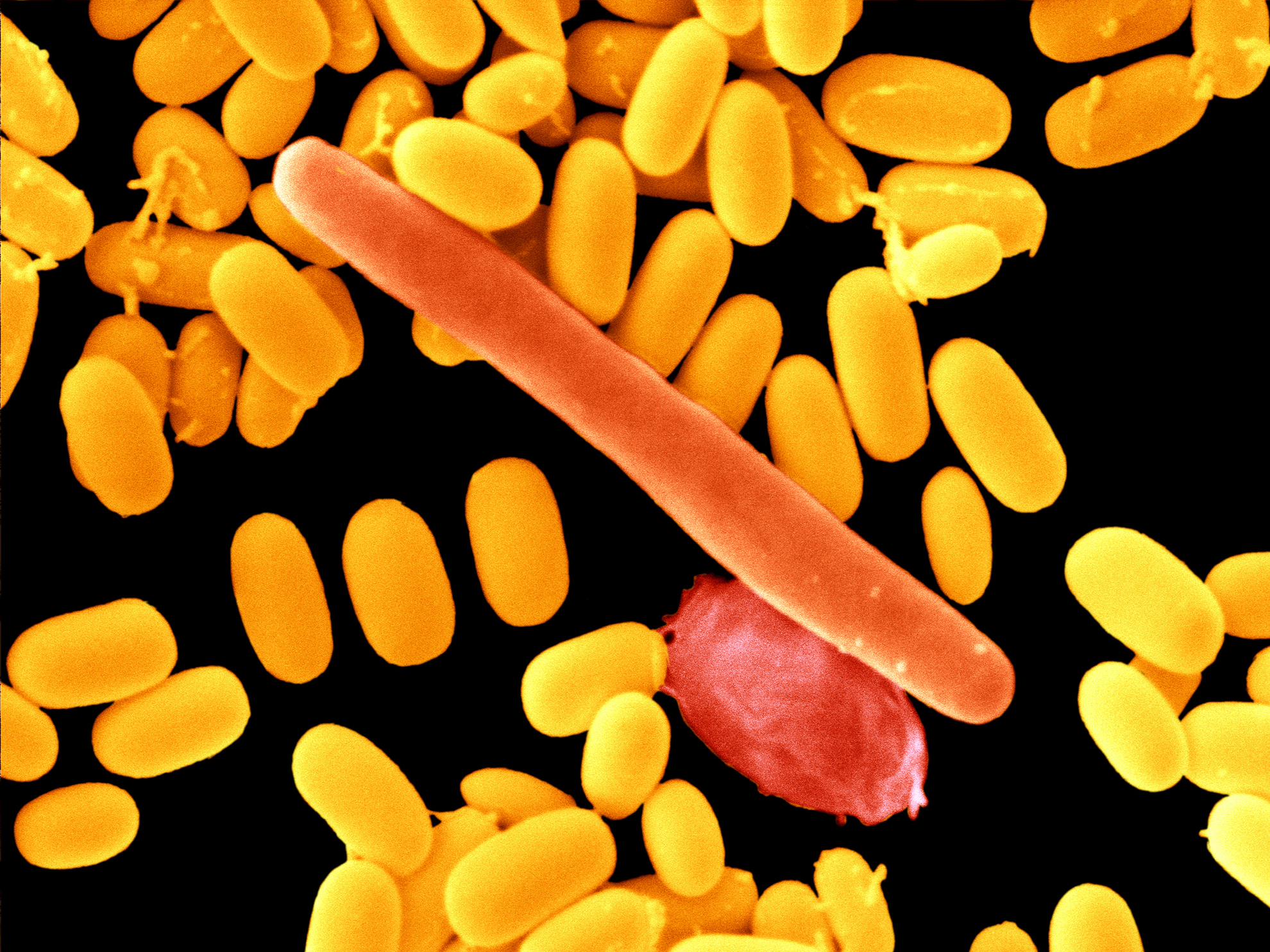 MRSA And C. Diff. Trigger Hospital Penalties From Medicare : Shots