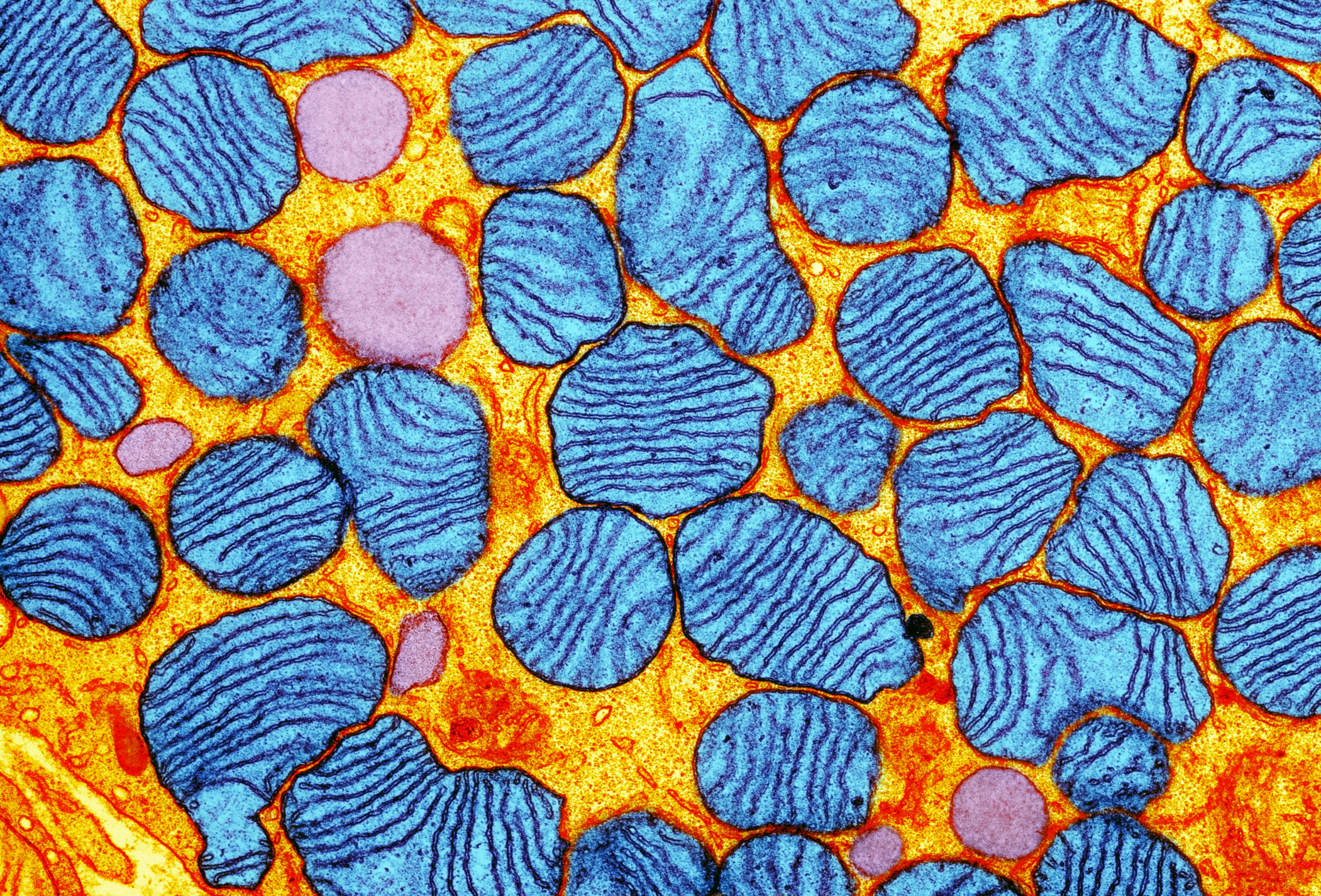 The genes in mitochondria, which are the powerhouses in human cells, can cause fatal inherited disease. But replacing the bad genes may cause other health problems. (Getty Images/Science Photo Library)