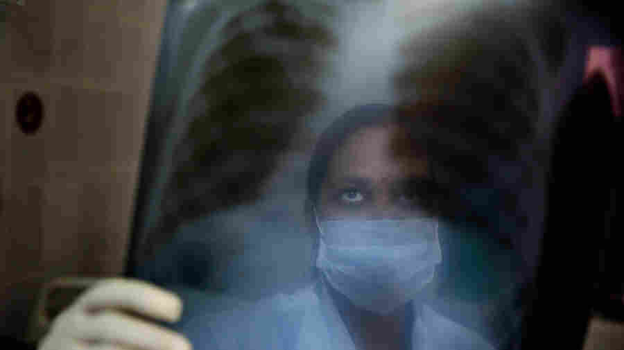 A Teen's Family Fought To Get Her A Restricted TB Drug — And Won