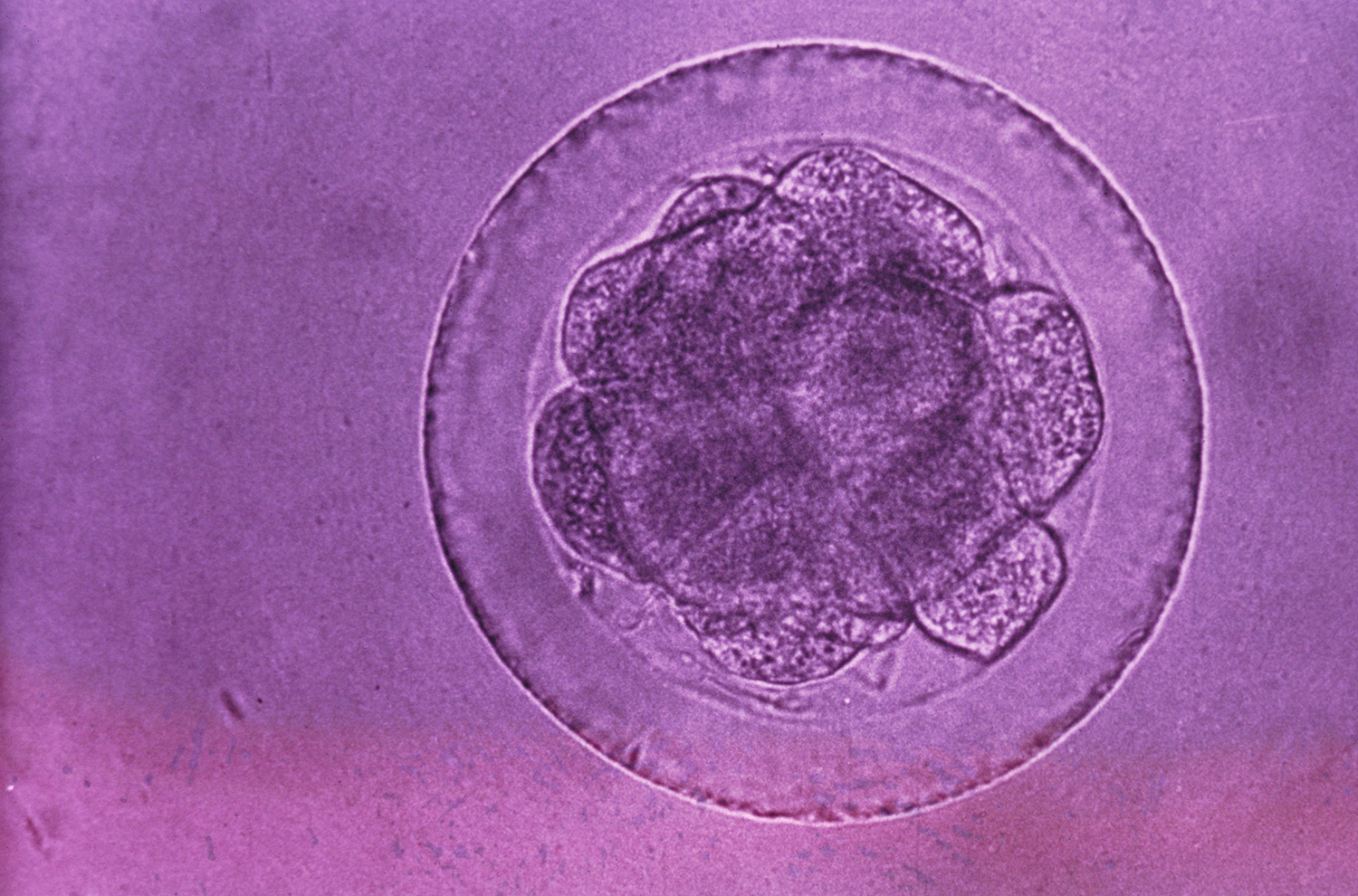 Editing human genes that would be passed on for generations could make sense if the diseases are serious and the right safeguards are in places, a scientific panel says. (Science Source)