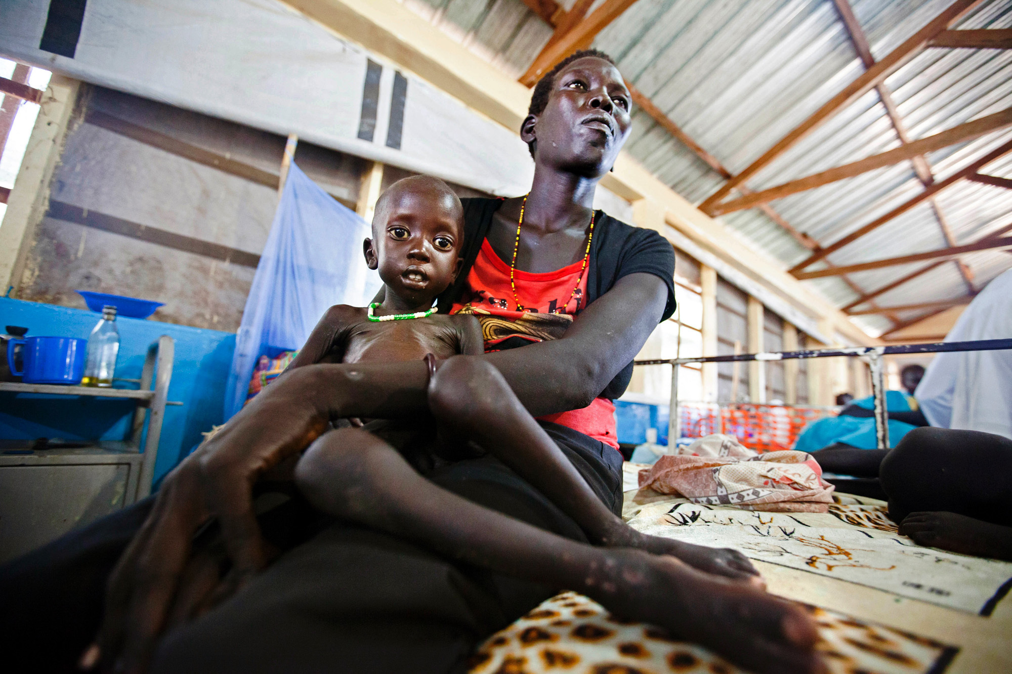 Lucia Adeng Wek holds her 3-year-old son, Wek Wol Wek, who suffers from malnutrition. They're at a clinic in South Sudan run by Doctors without Borders and were photographed on October 11, 2016. (AFP/Getty Images)