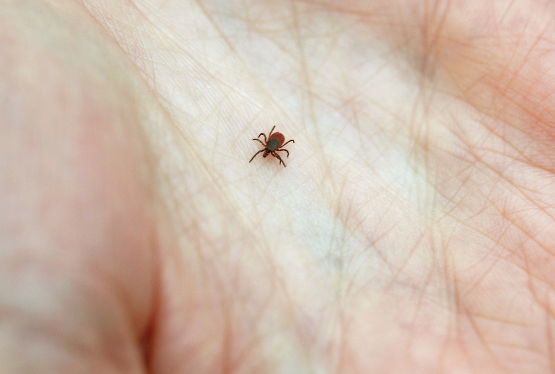 Don't Panic If You Get Bit By A Tick. Here Are 5 Tips To Minimize Lyme ...