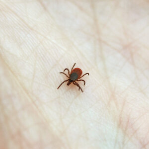 Did You Get Bit By A Lyme-Infested Tick? Here's What To Do