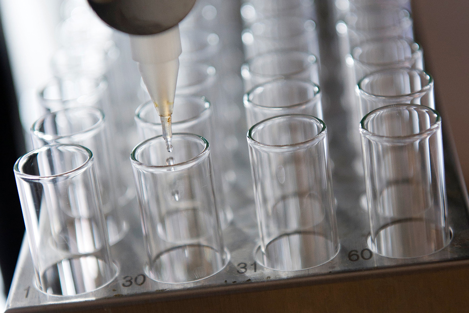 Gilead Sciences Inc. makes the two leading drugs that can quickly cure hepatitis C infections. But most patients can't afford the expensive drugs, and states restrict their use among Medicaid patients. (David Paul Morris/Bloomberg via Getty Images)