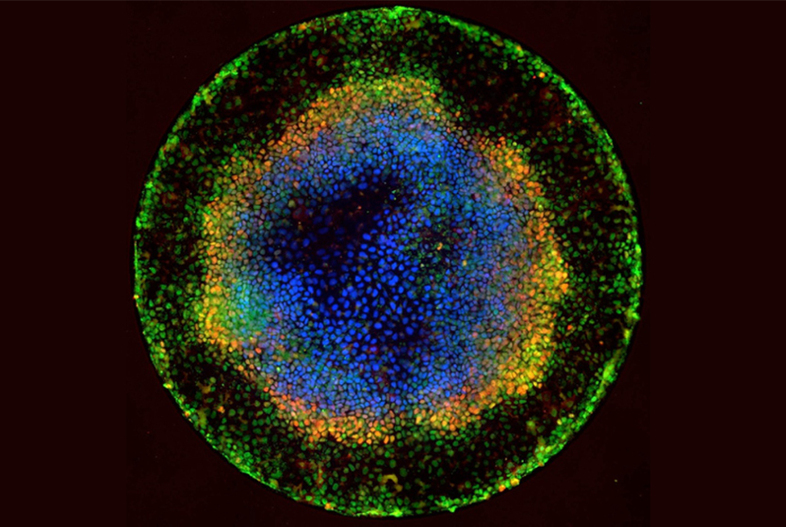 Embryoids like this one are created from stem cells and resemble very primitive human embryos. Scientists are studying them in hopes of learning more about basic human biology and development. (Courtesy of Rockefeller University)