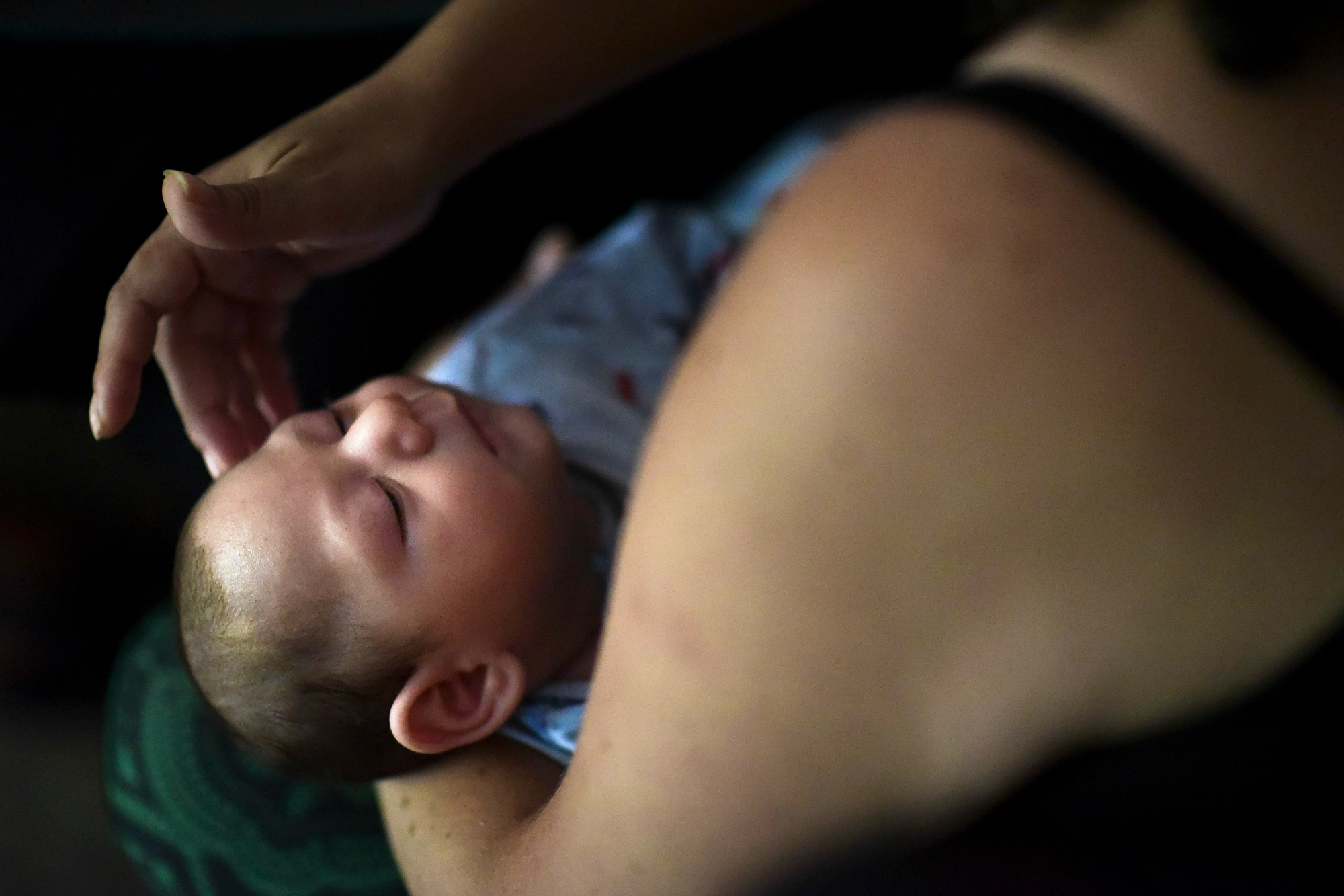 Puerto Rico resident Michelle Flandez caresses her two-month-old son Inti Perez, diagnosed with microcephaly linked to the mosquito-borne Zika virus. The U.S. Centers for Disease Control and Prevention says the Zika virus continues to impact a small number of pregnant women and their babies in the U.S.