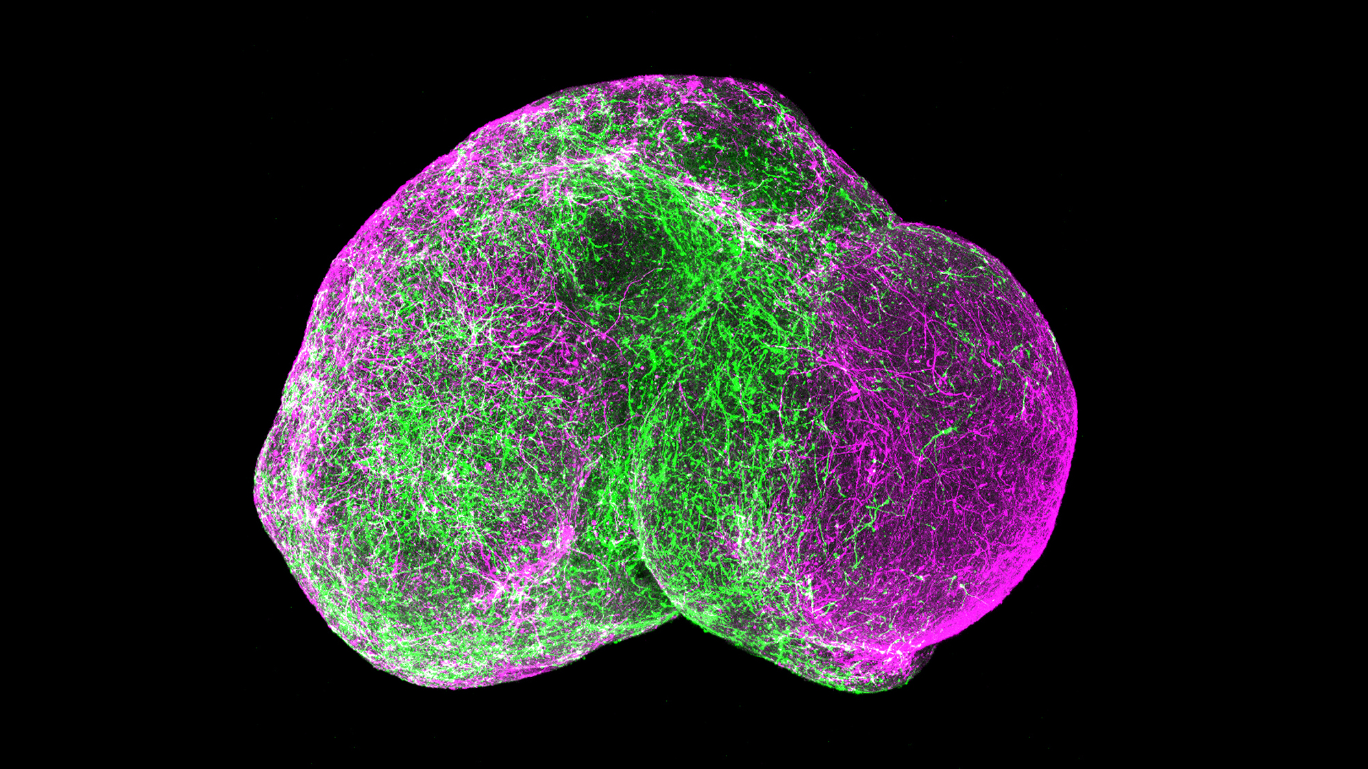 Scientists placed two clusters of cultured forebrain cells side by side (each cluster the size of a head of a pin). Within days, the &quot;minibrains&quot; had fused and particular neurons (in green) migrated from the left side to the right side, as subsets of cells do in a real brain. (Courtesy of Pasca lab/Stanford University)