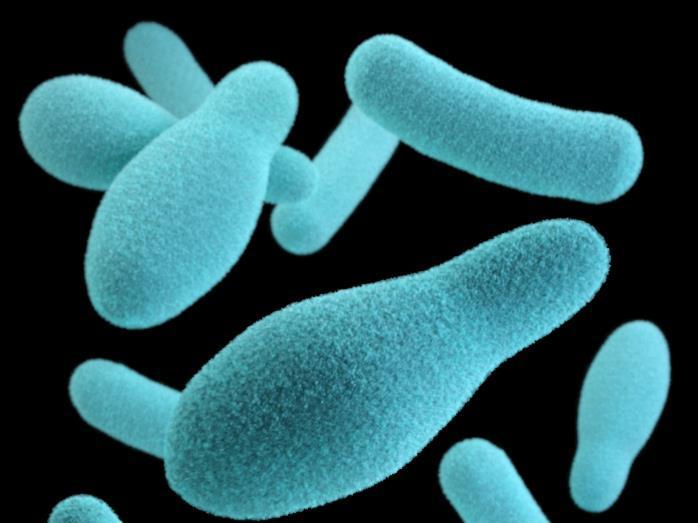 Nacho Cheese Sauce Tainted With Botulism Kills California Man