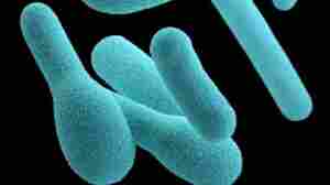 Nacho Cheese Sauce Tainted With Botulism Kills California Man