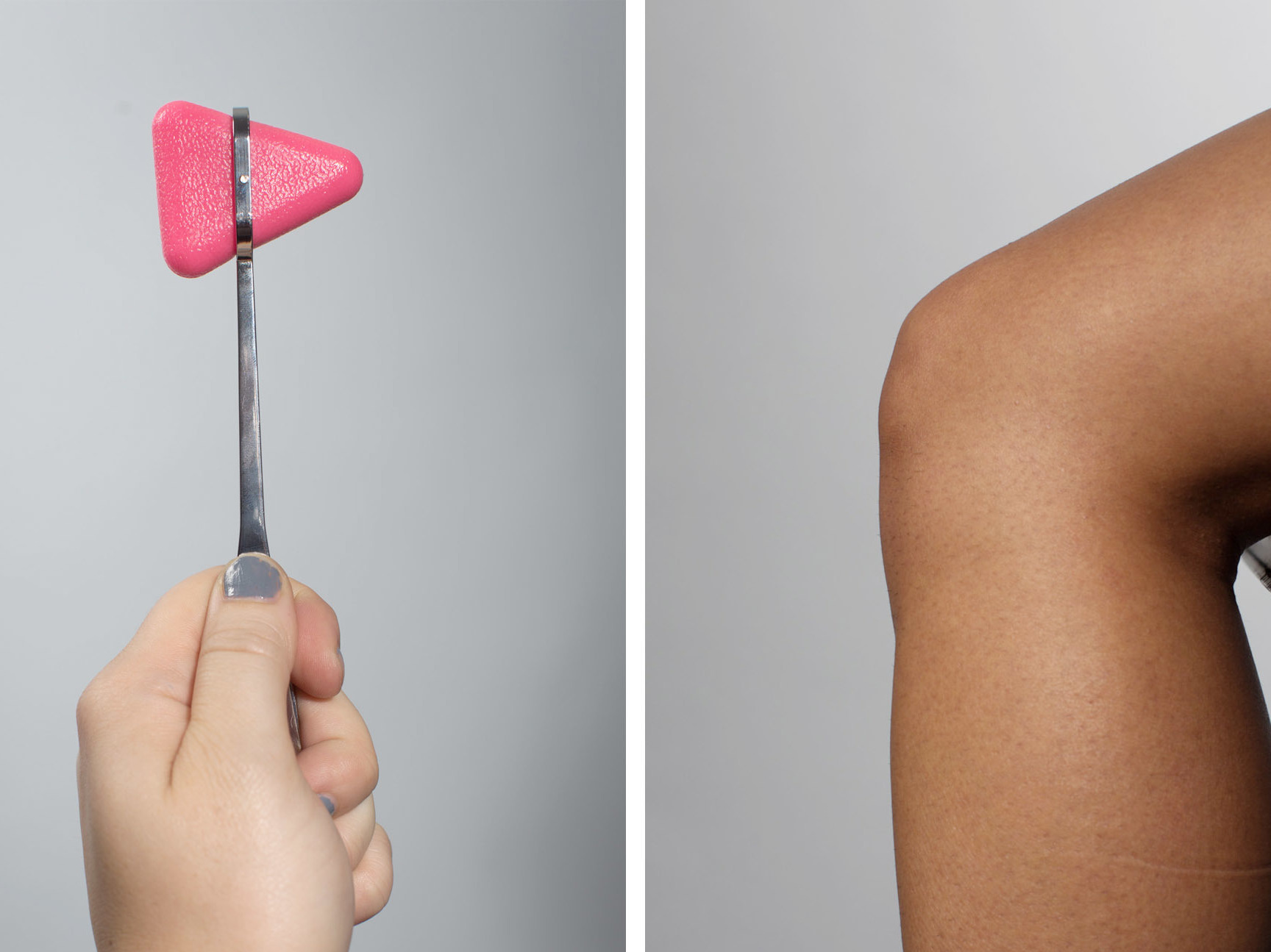 In The Age Of Digital Medicine, The Humble Reflex Hammer Hangs On