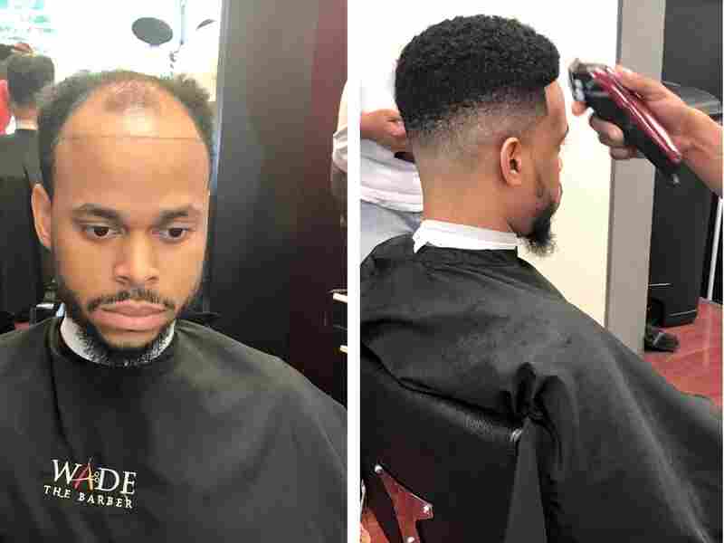 'Man Weaves' Offer Cover For Balding Men, Cash For Black Hair Care Industry