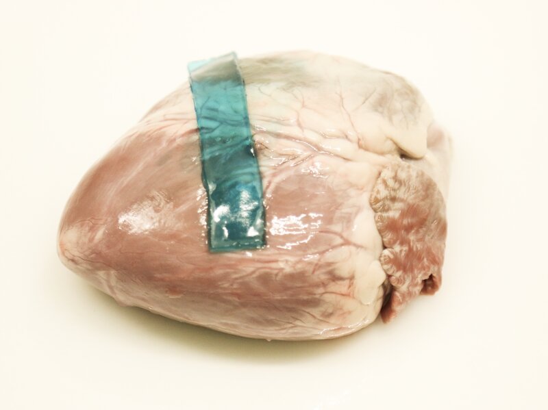 Slug Slime Inspires Scientists To Invent Surgical Glue Shots Health News Npr