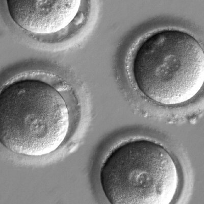 Scientists Precisely Edit DNA In Human Embryos To Fix A Disease Gene