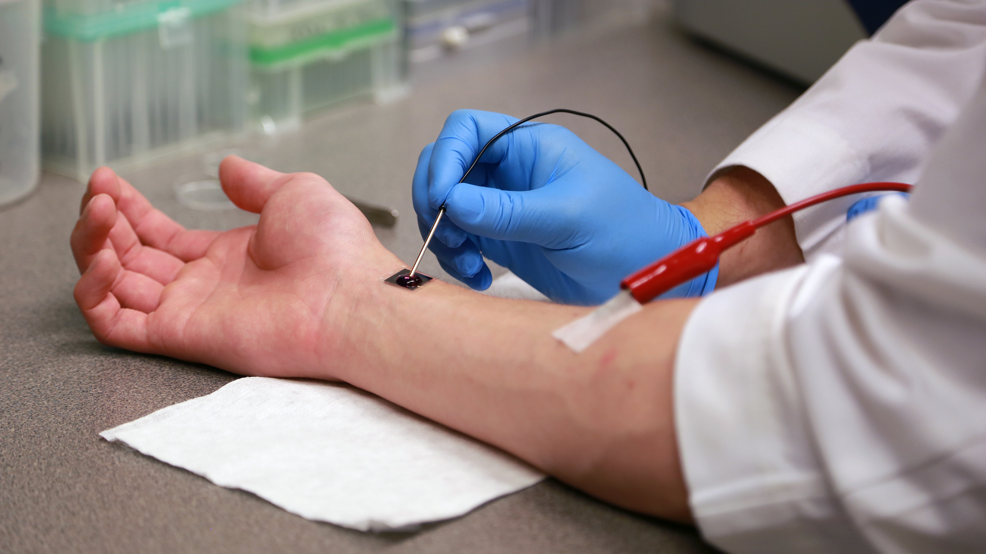 Chip Reprograms Cells To Speed Healing In Mice Shots Health News NPR