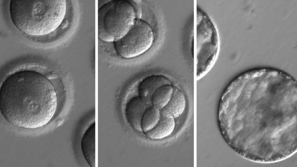 This sequence of images shows the development of embryos formed after eggs were injected with both CRISPR, a gene-editing tool, and sperm from a donor with a genetic mutation known to cause cardiomyopathy.