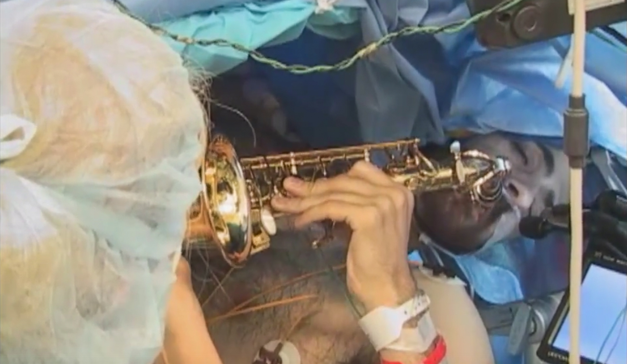 This Music Teacher Played His Saxophone While In Brain Surgery NPR