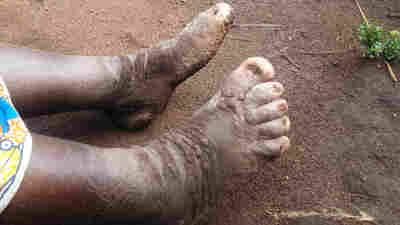 Whatever Happened To ... Those Farmers Who Needed Shoes?