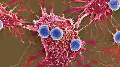 FDA Approves First Gene Therapy For Leukemia