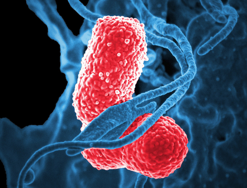 A newly detected type of <em>Klebsiella pneumoniae</em> bacteria (in red) has acquired genes that make it more deadly. (Science Source)