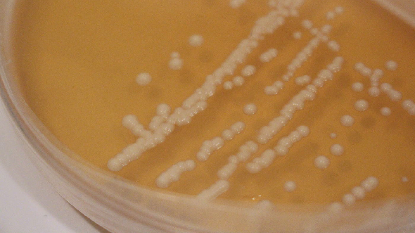 Insect yeast1 wide 54103aac714300a7b05efe893c22a8d7ab8b10b3