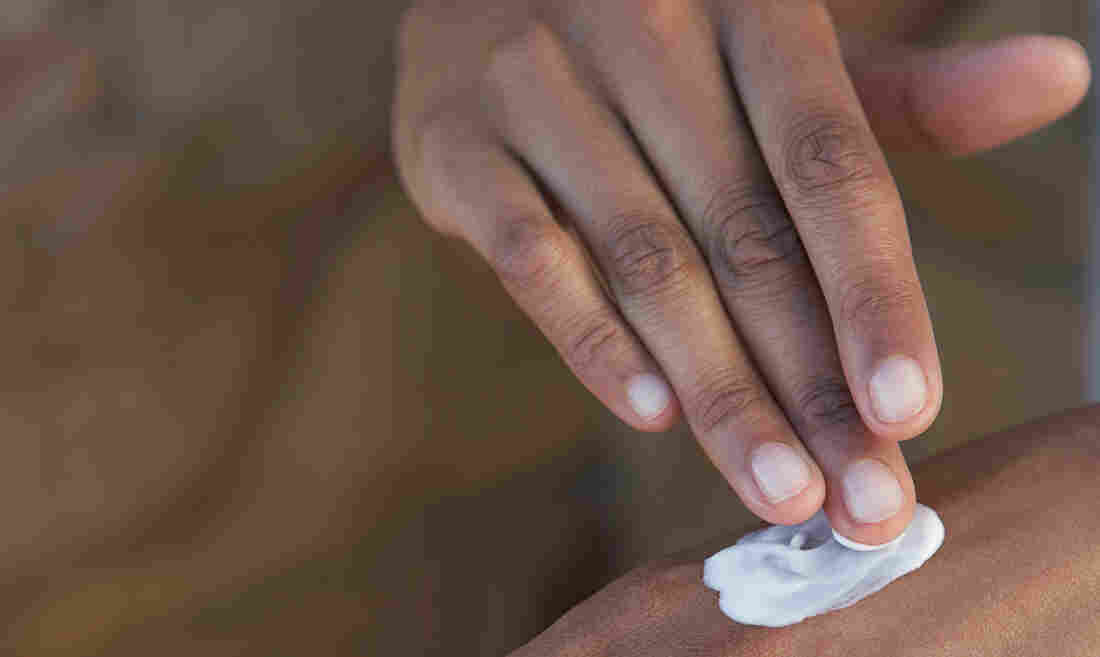 Some creams sold for skin lightening can contain high levels of steroids.