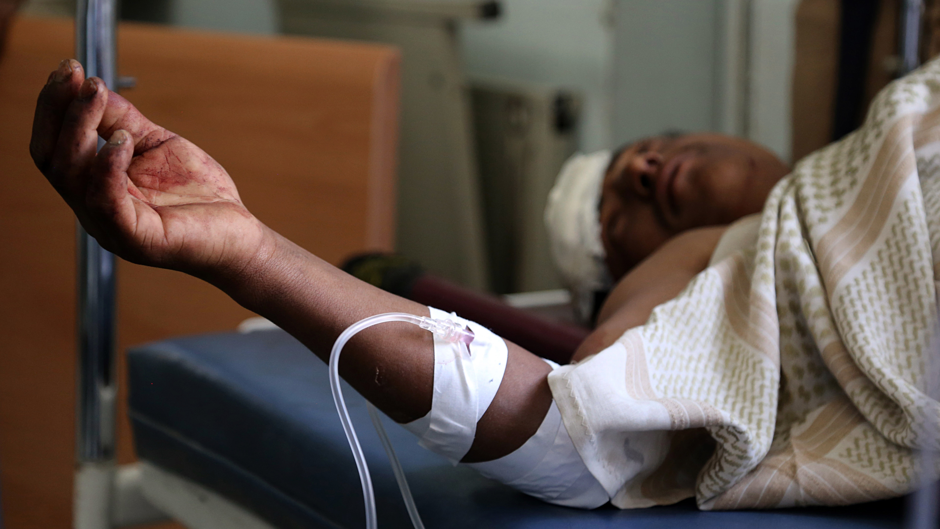 A Yemeni man receives treatment at a hospital after a Saudi-led coalition airstrike in Taez, Yemen, on Tuesday. (AFP/Getty Images)