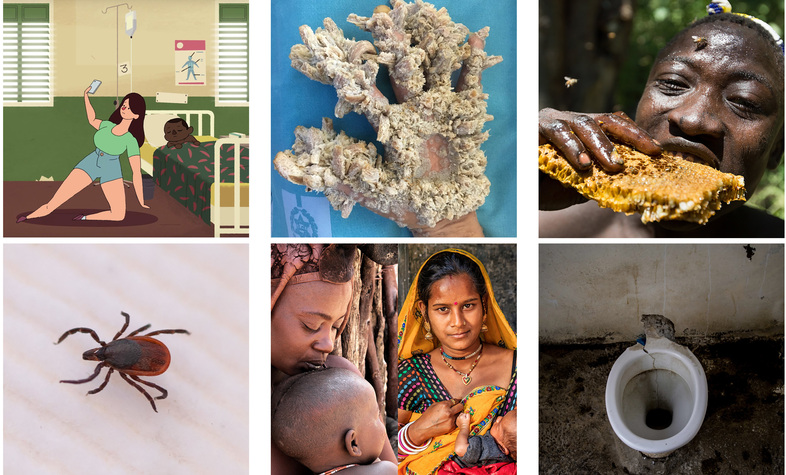 Clockwise from top left: Bad selfie; "tree man" disease; Hadza man eating honeycomb; toilet from Amber, India; mothers from Namibia's Himba tribe and deer tick. (Clockwise from top left: SAIH Norway/Screenshot by NPR; Hadassah; Matthieu Paley/National Geographic; Zoriah Miller for Dollar Street; Jose Luis Trisan/Getty; Hadynyah/Getty; and Stephen Reiss for NPR.)