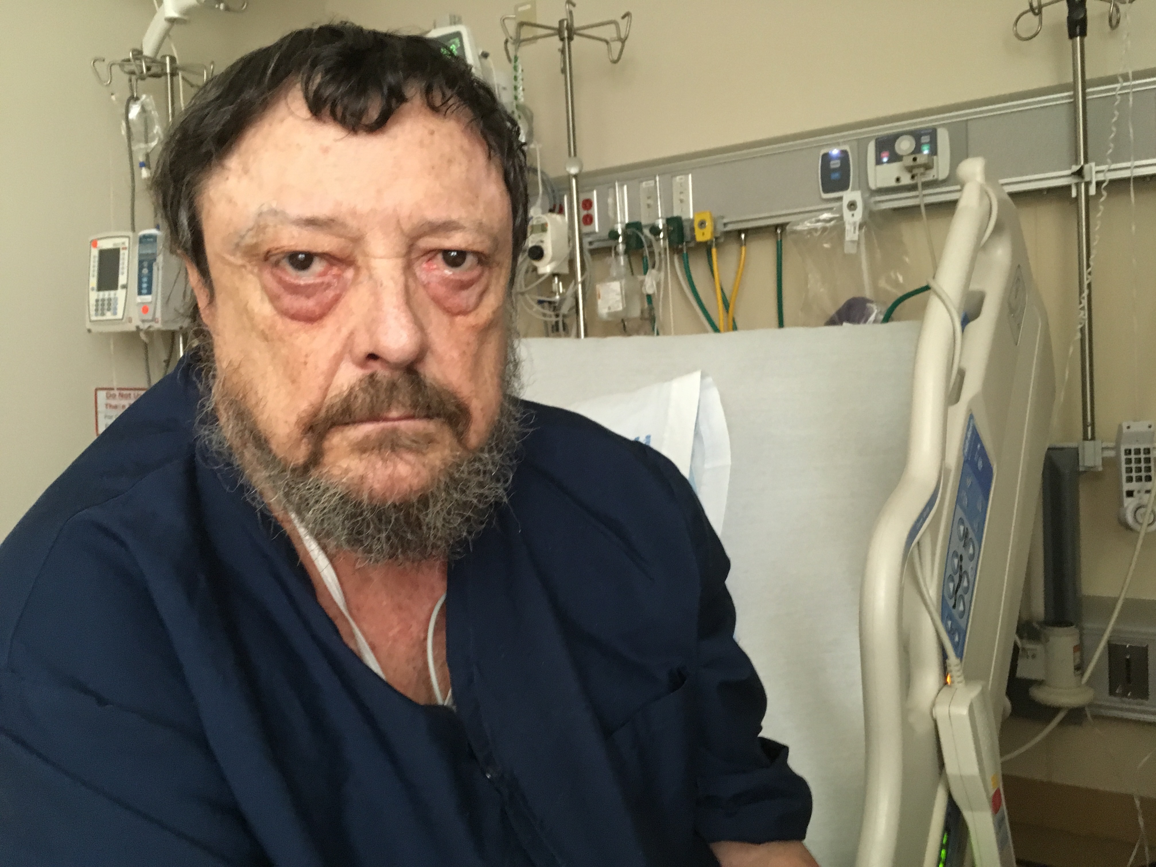 Ron Fleming, who served as a door gunner<strong> </strong>on helicopters in the Vietnam War, was admitted to the veterans hospital in San Francisco recently because of an asthma attack. Fleming has PTSD, but told his doctors he doesn't want to take medicine for it. He's concerned the pills might dull the emotional connection he feels to his wartime past. (April Dembosky / KQED)