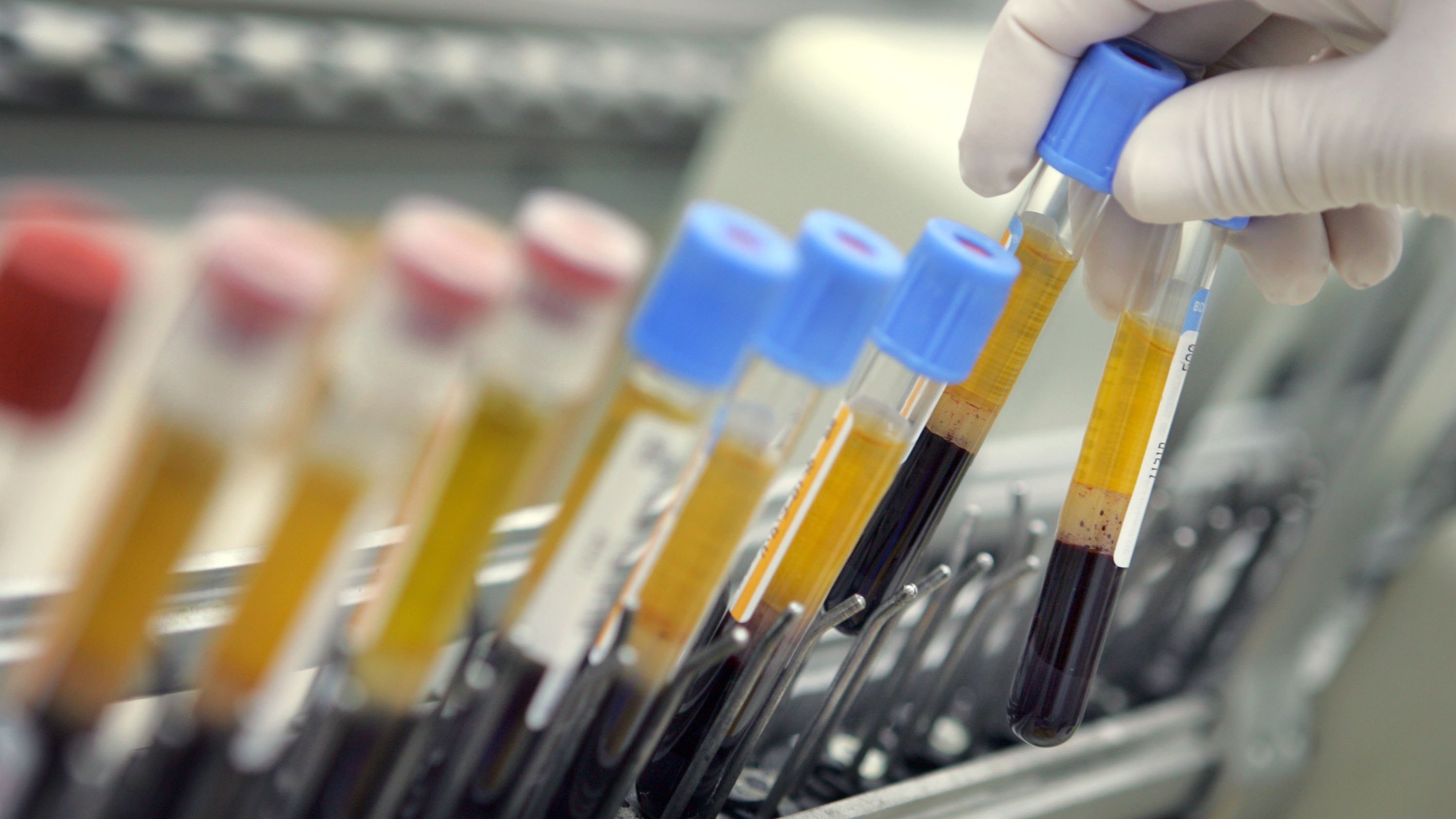 Careful custody of blood tests and tissue samples is essential to the success of precision medicine. (Getty Images)