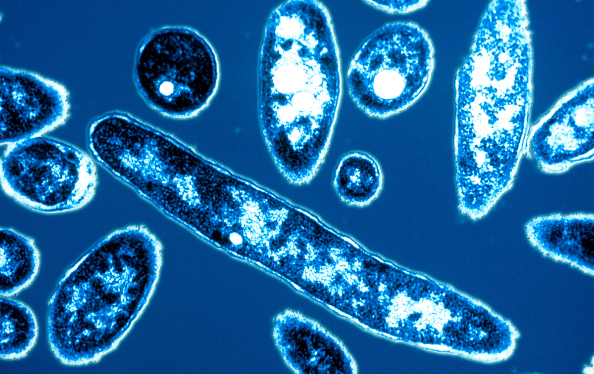 Lethal Pneumonia Outbreak Caused By Low Chlorine In Flint Water Shots