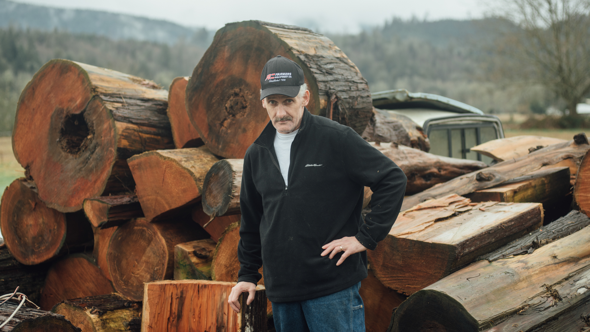 Experimental Treatment For Sepsis May Have Saved This Lumberjack