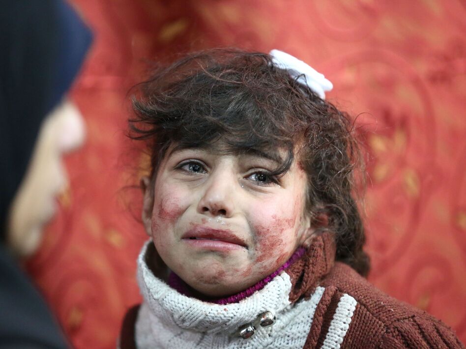 Hala, 9, receives treatment at a makeshift hospital following Syrian government bombardments on rebel-held town of Saqba, in Eastern Ghouta, on Thursday. (Amer Almohibany/AFP/Getty Images)