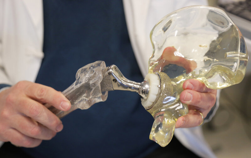 vanishing bone plastic was weakness of hip implants shots hip replacements materials