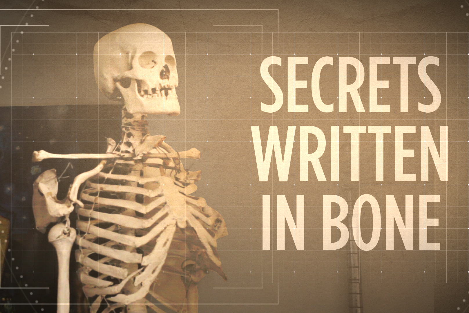 Classroom Skeleton Whose Bones Are These Npr Ed Npr