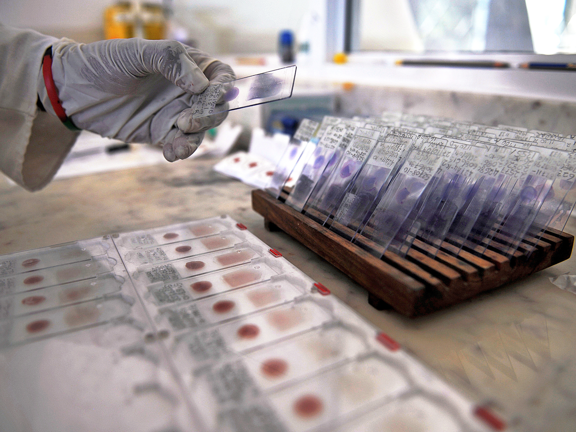 A laboratory technician prepares blood samples from volunteers for viral-genotyping at the government-run Ifakara Health Institute in Bagamoyo, Tanzania. (AFP/Getty Images)