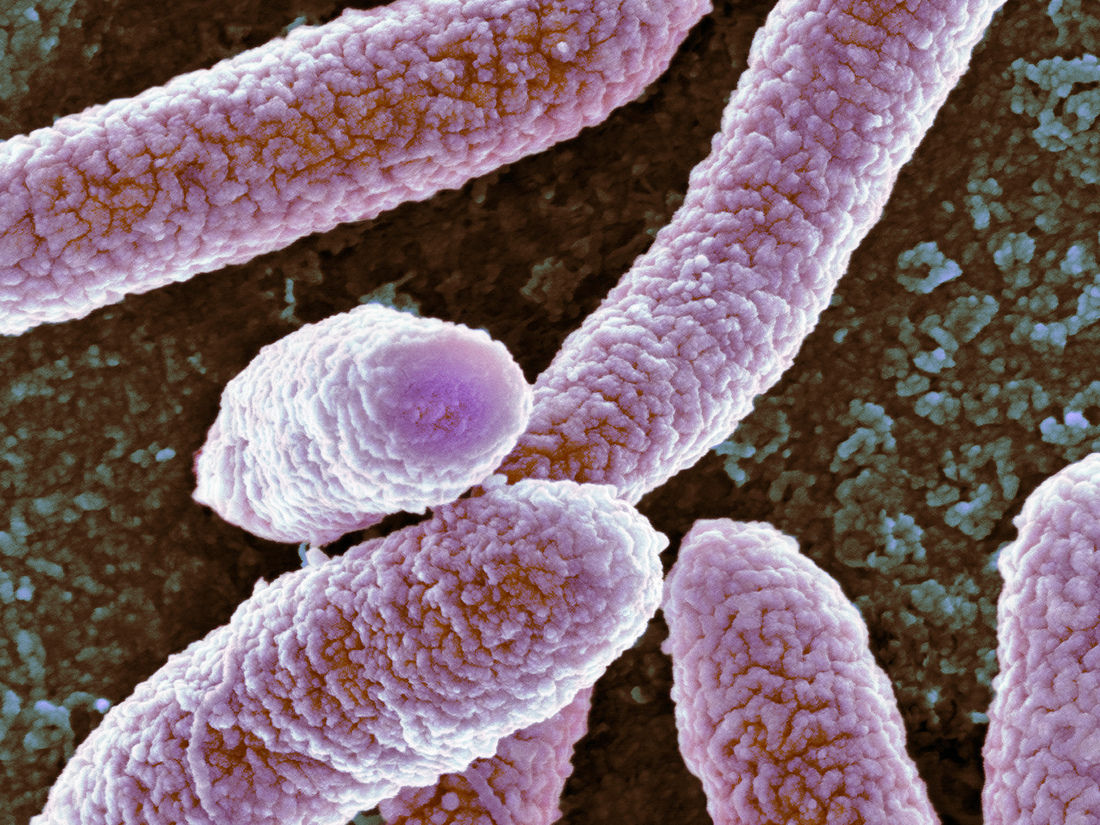 CDC Reports Efforts To Track 'Nightmare Bacteria' Is Turning Up Shots