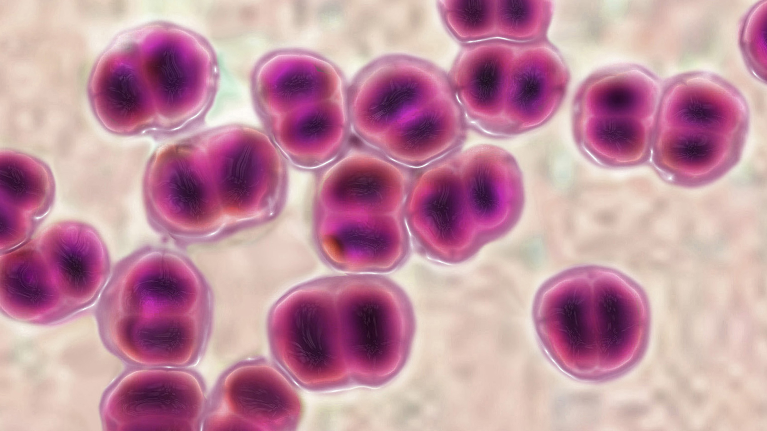 This bacterium is the cause of the mystery illness in Liberia. We don't want to give it away ... so you'll have to read the story to find out what it is. (Getty Images)
