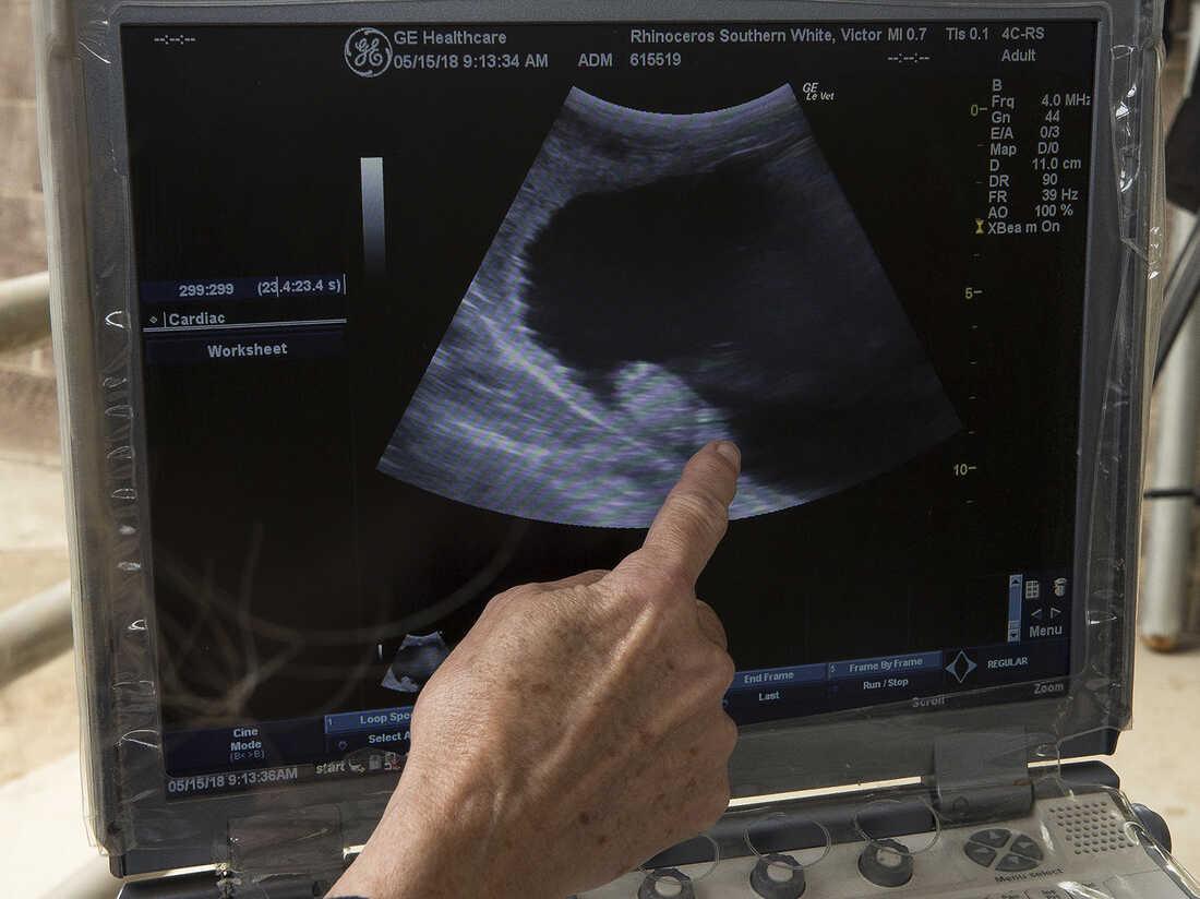 X Ray Impregnation Caption X Ray Impregnation Caption