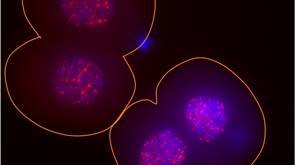 In these two two-cell mouse embryos, the surface of the embryos is outlined in orange, the DNA in the nucleus is indicated in blue and the activity of the LINE-1 gene is indicated via bright red spots.
