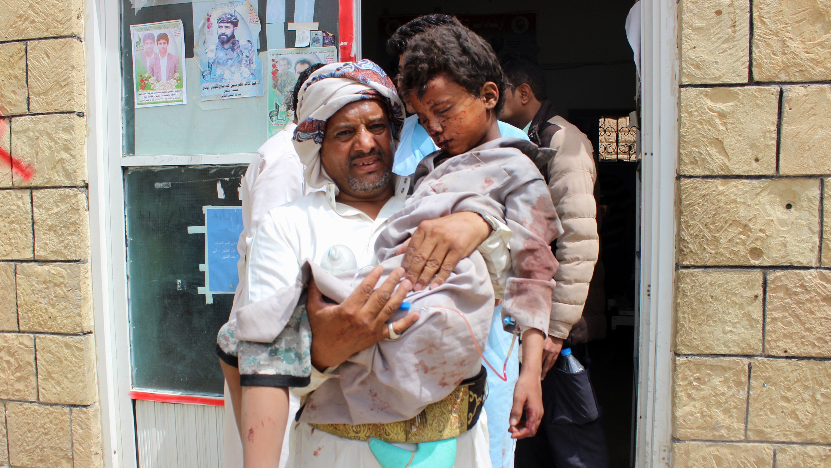 A man carries a wounded child to the hospital Thursday after the Saudi-led coalition carried out an airstrike on a crowded area in Houthi-controlled Saada province. At least 29 children under the age of 15 were killed in the attack, according to the International Committee of the Red Cross. (AFP/Getty Images)