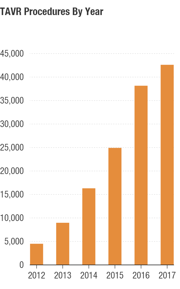 Minimally invasive replacements of aortic valves are on the rise.