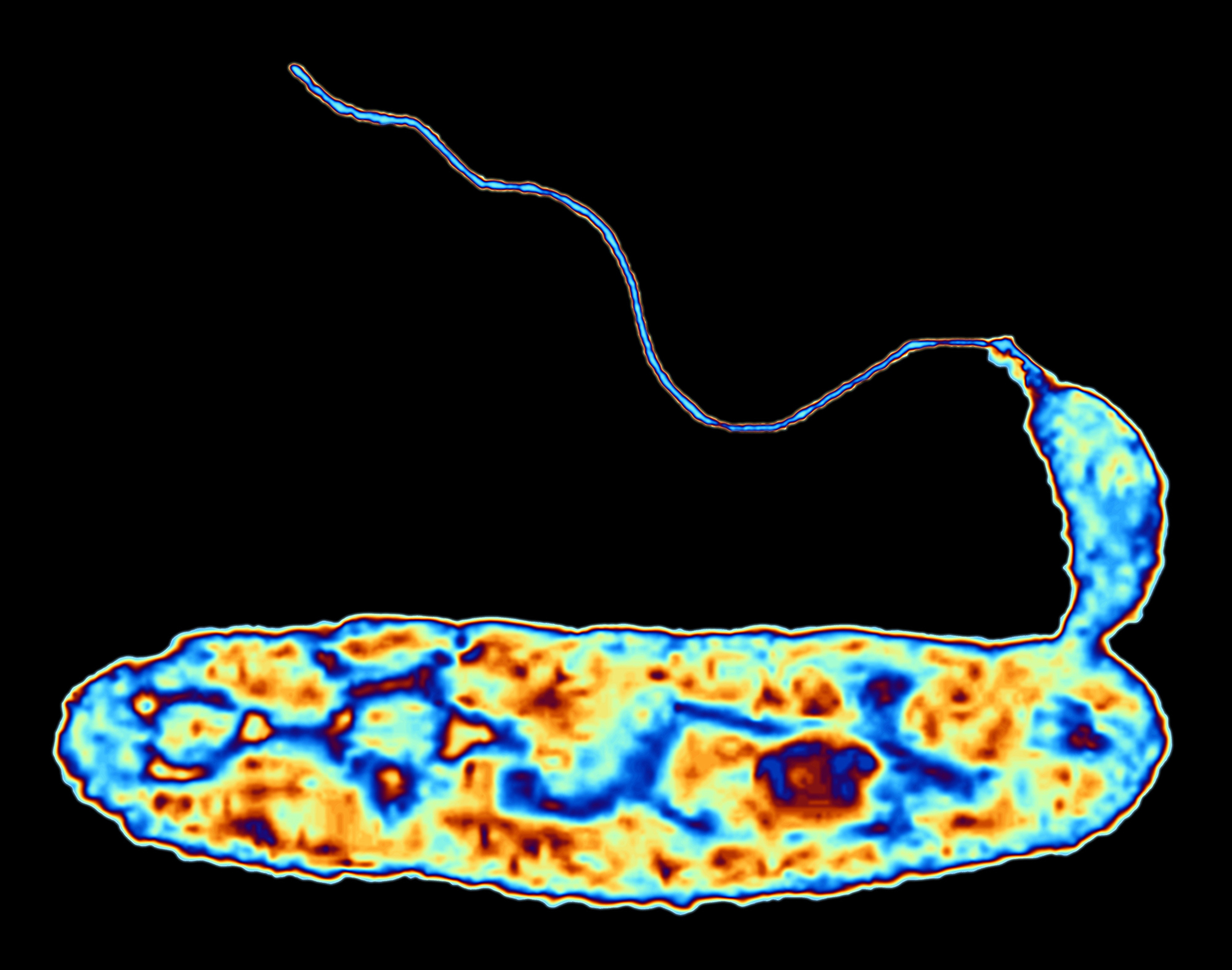 <em></em>It's a bacteria-eat-bacteria world, scientists say. <em>Bdellovibrio bacteriovorus, <strong></strong></em>shown here in false color, attacks common germs six times its size, then devours them from the inside out. (Alfred Pasieka/Science Source)