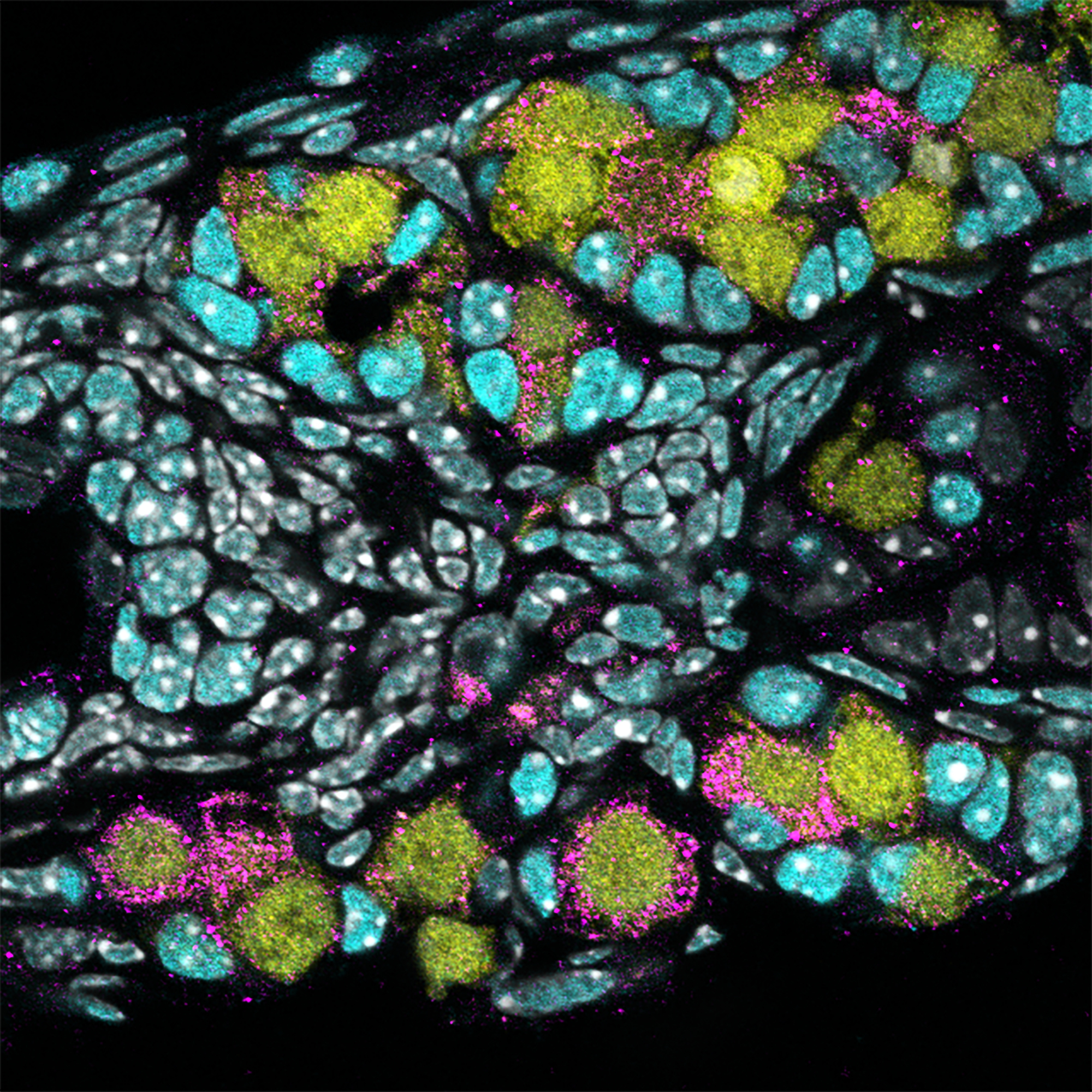 Immature human eggs (pink) were created by Japanese researchers using stem cells that were derived from blood cells. (Courtesy of Saitou Lab)
